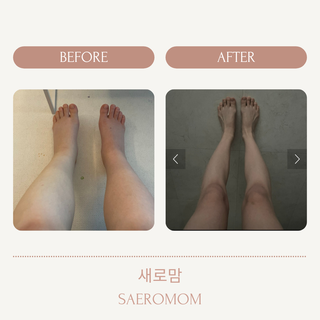 3555412180_viZLYzO1_b8107a6f99b2499e886dfdcd0a82ada5dcf16337.png 이미지크게보기