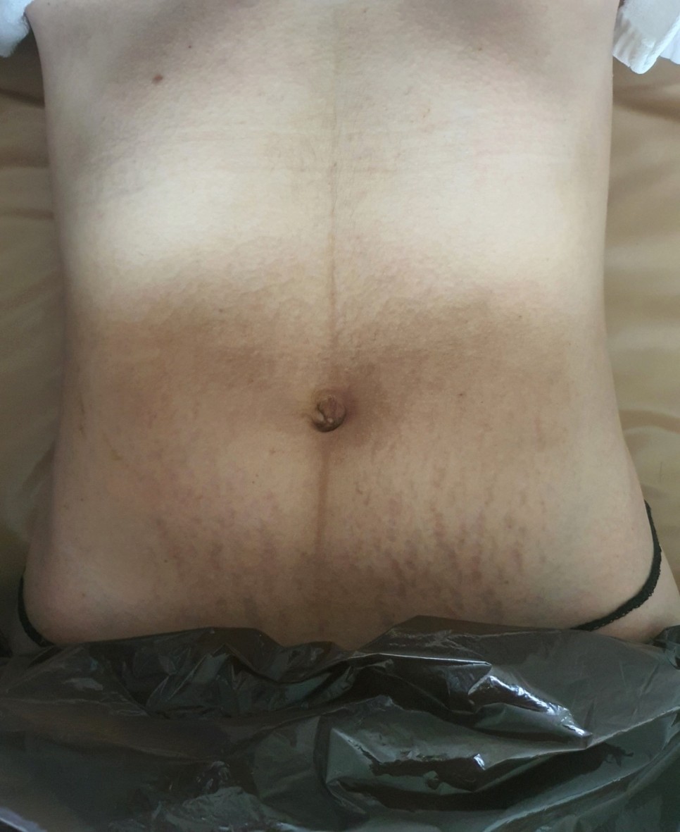 /user/s/saeromom/editor/2309/151d62c717e3affeb7e044a4b5b852d3_1695082635_3582.jpg 이미지크게보기